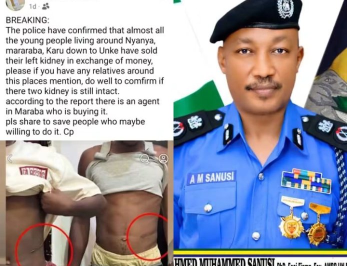 FCT Police Debunks Viral Claim of Kidney Sales in Nyanya, Urges Public to Ignore False Reports