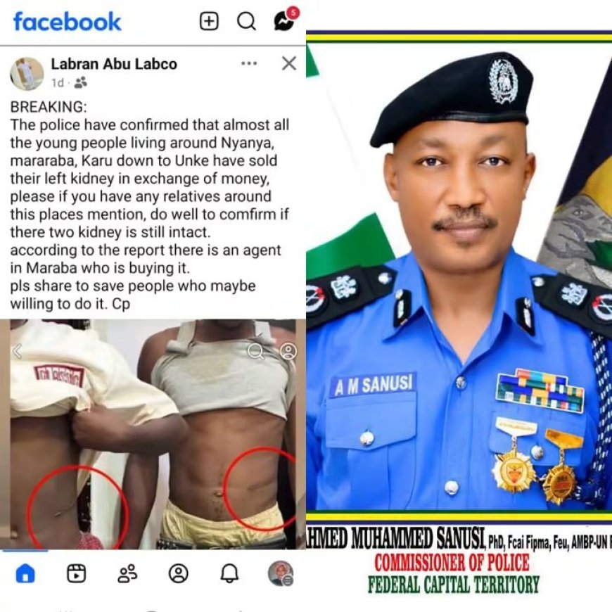 FCT Police Debunks Viral Claim of Kidney Sales in Nyanya, Urges Public to Ignore False Reports